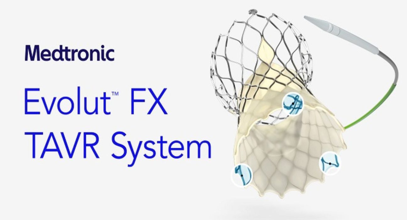 Advancements in Transcatheter Aortic Valve Replacement The Promising Evolut FX TAVR System